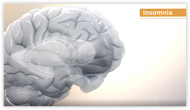 Mode of Action Video